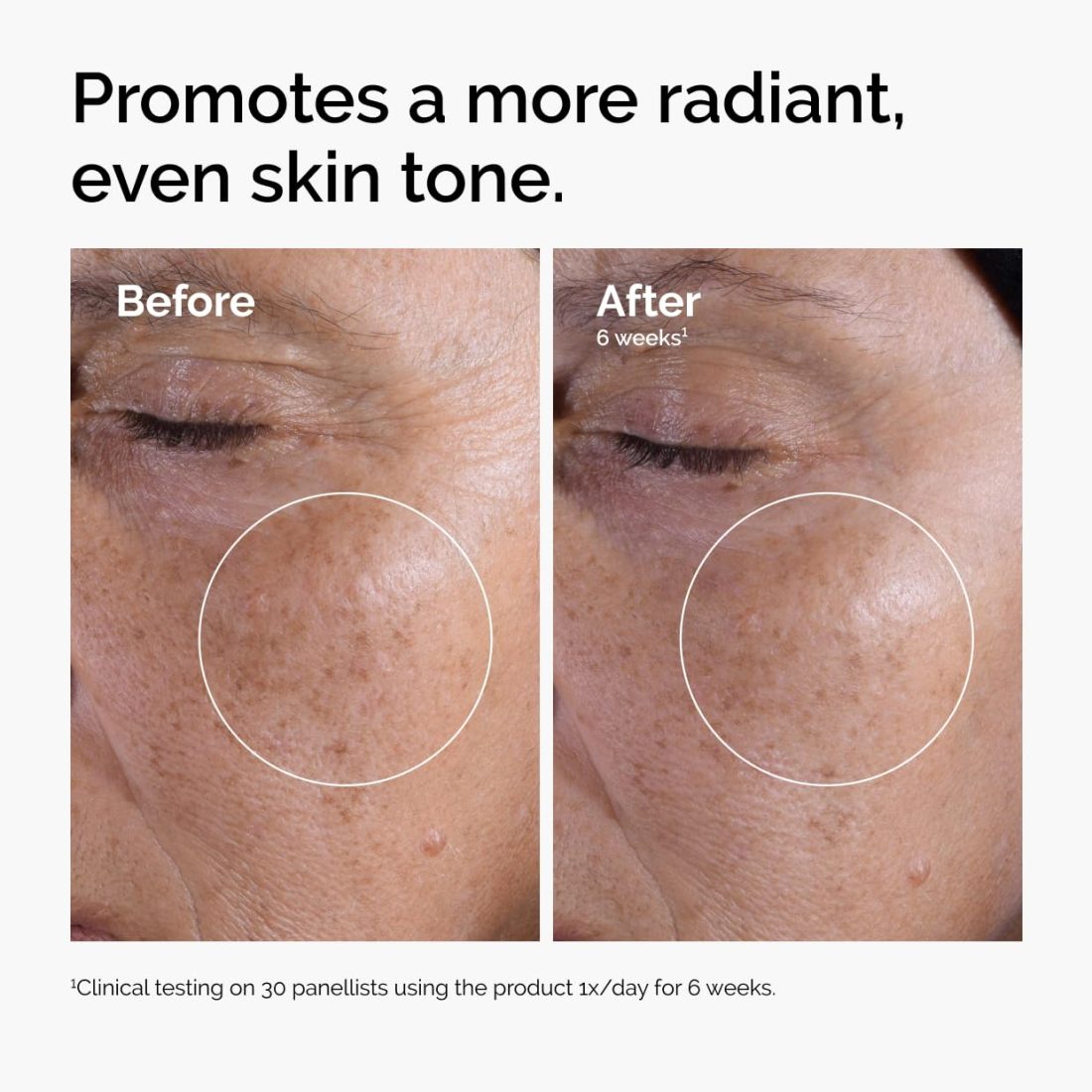 تونر گلیکولیک اسید ۷٪ اوردینری (روشن‌کننده و لایه‌بردار) | The Ordinary Glycolic Acid 7% Toning Solution — 4