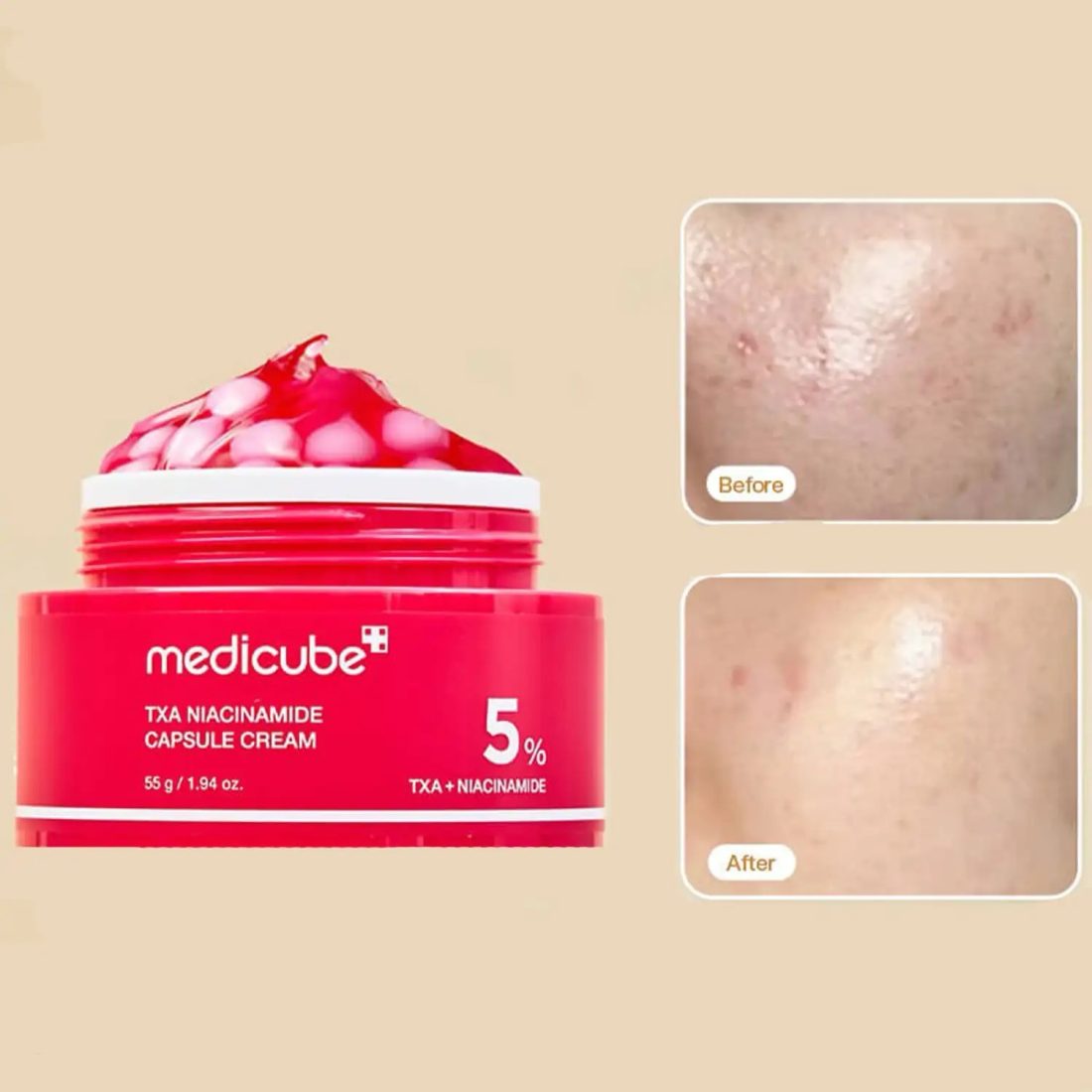 کرم کپسولی ضد لک ترانگزامیک اسید و نیاسینامید medicube مدی کیوب TXA — 2